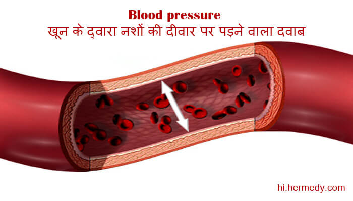 blood pressure in hindi