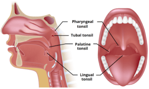 Sore throat in Hindi | गले में ख़राश व दर्द: लक्षण, कारण, इलाज