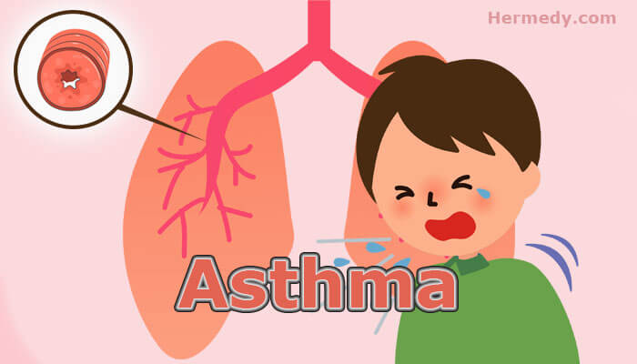 Asthma in Hindi