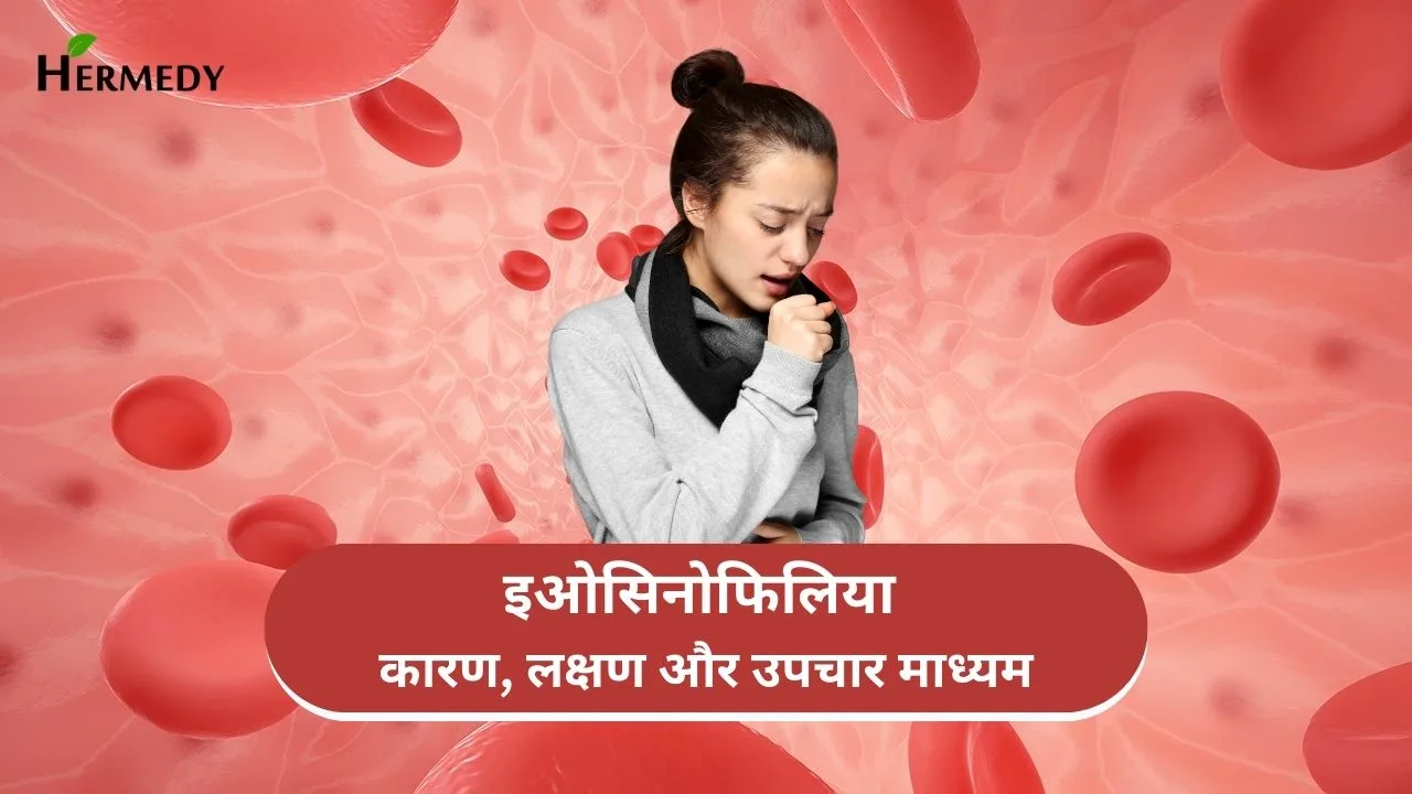 Eosinophilia in Hindi