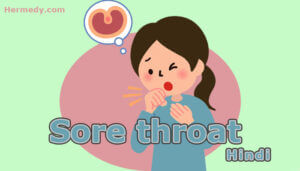 Sore throat in Hindi | गले में ख़राश व दर्द: लक्षण, कारण, इलाज