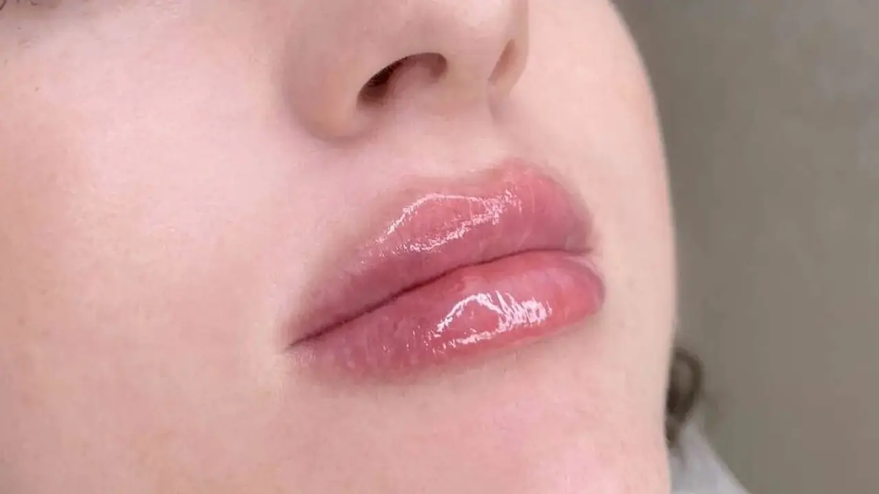 Lip Fillers In Hindi Hermedy