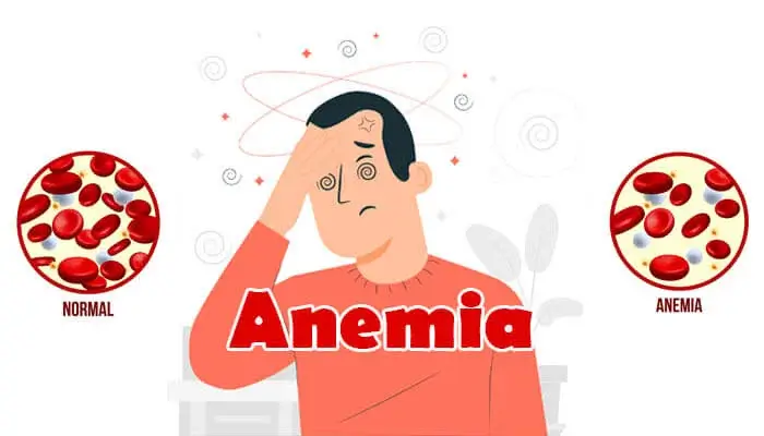 anemia in hindi